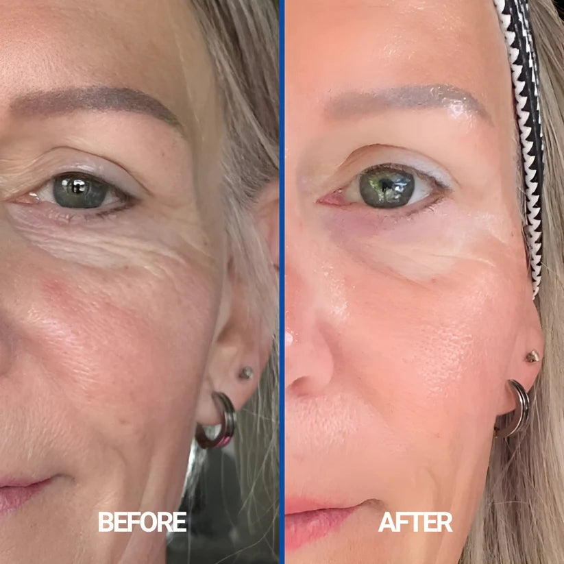 Oskyn Silicone Facial Patches